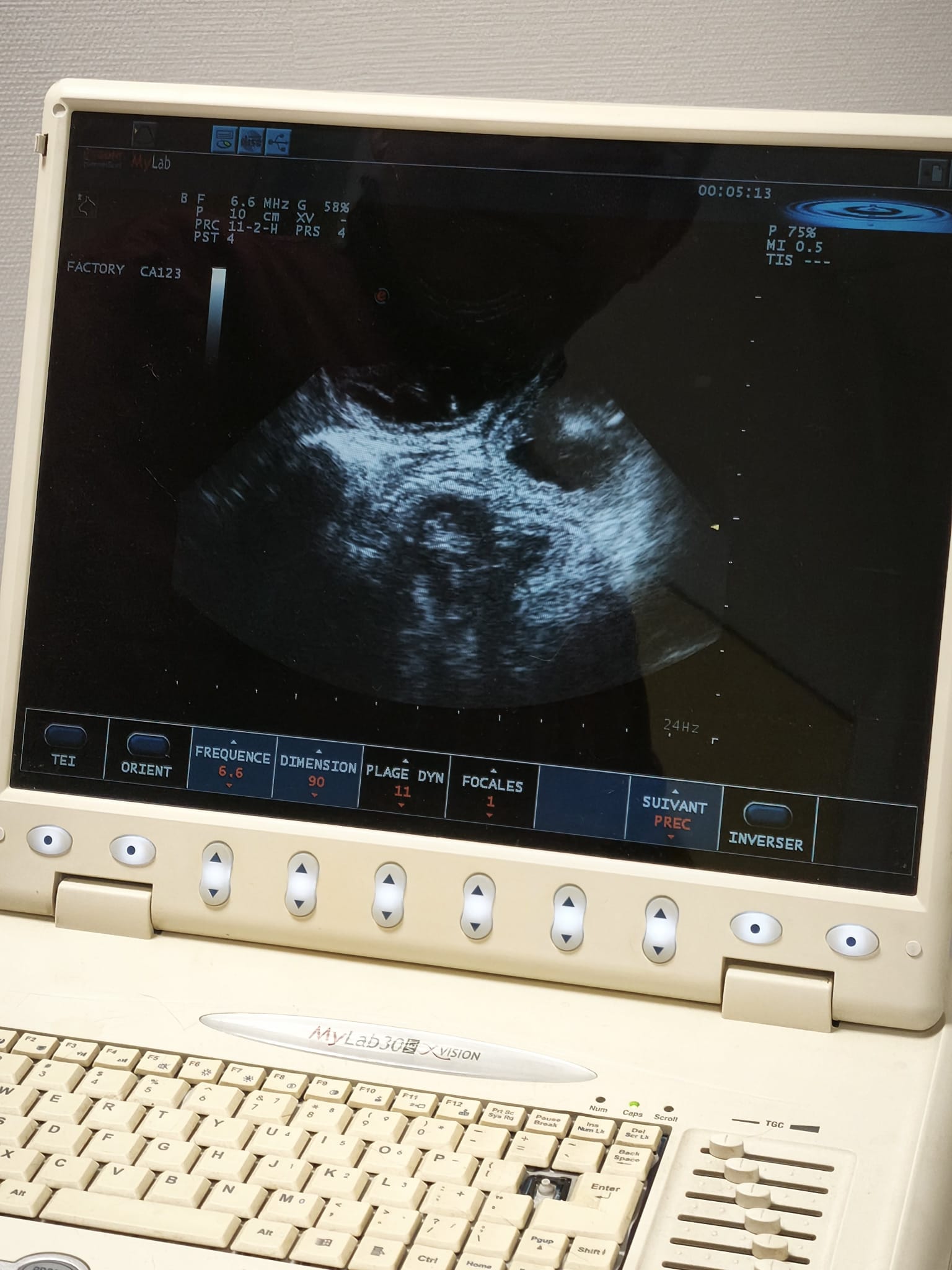 "Heureux événement a la chatterie, une nouvelle portée est en cours de fabrication : gestation confirmée et naissance des petites merveilles prévue pour fin mai ! N'hésitez pas à prendre contact rapidement pour réserver votre future boule d'amour 😁"